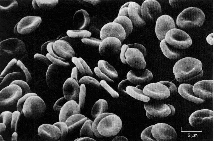 Kora komórki Film - efekty błonowe w erytrocytach Skaningowa mikrografia elektronowa erytrocytów ludzkich