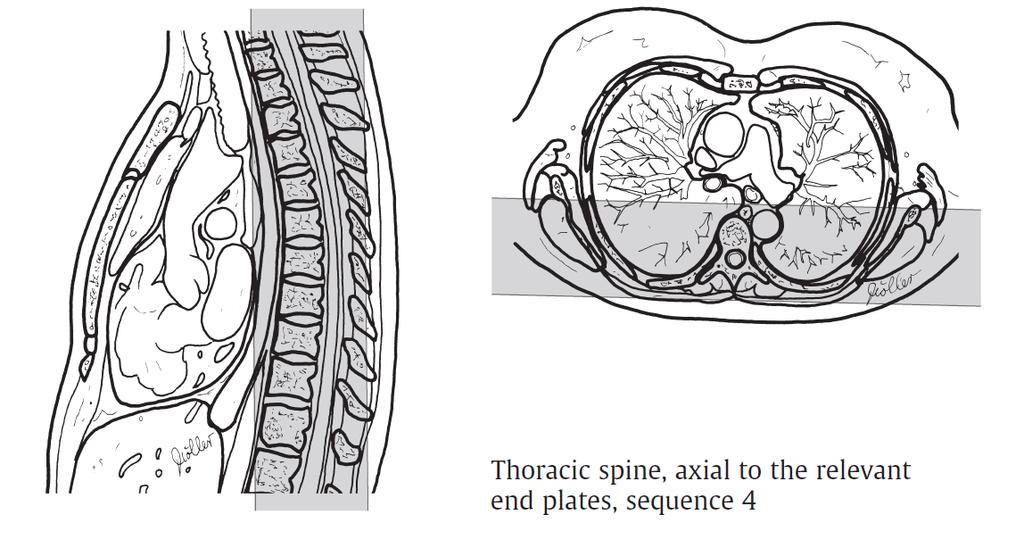 płaszczyzna koronalna= coronalna MRI parameters