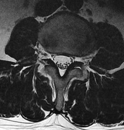 Sagittal