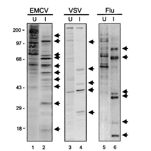 EMCV (Encephalomyocarditis Virus ) VSV (Vesicular