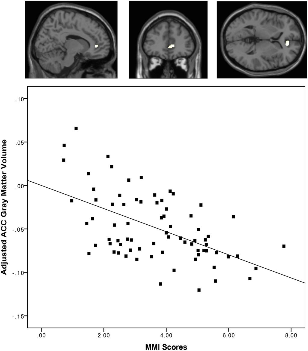 Technicyzacja neurodegeneracja Loh, K.K. and Kanai, R.