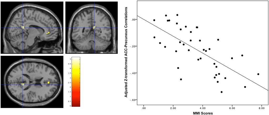 Higher media mulm- tasking acmvity is associated with