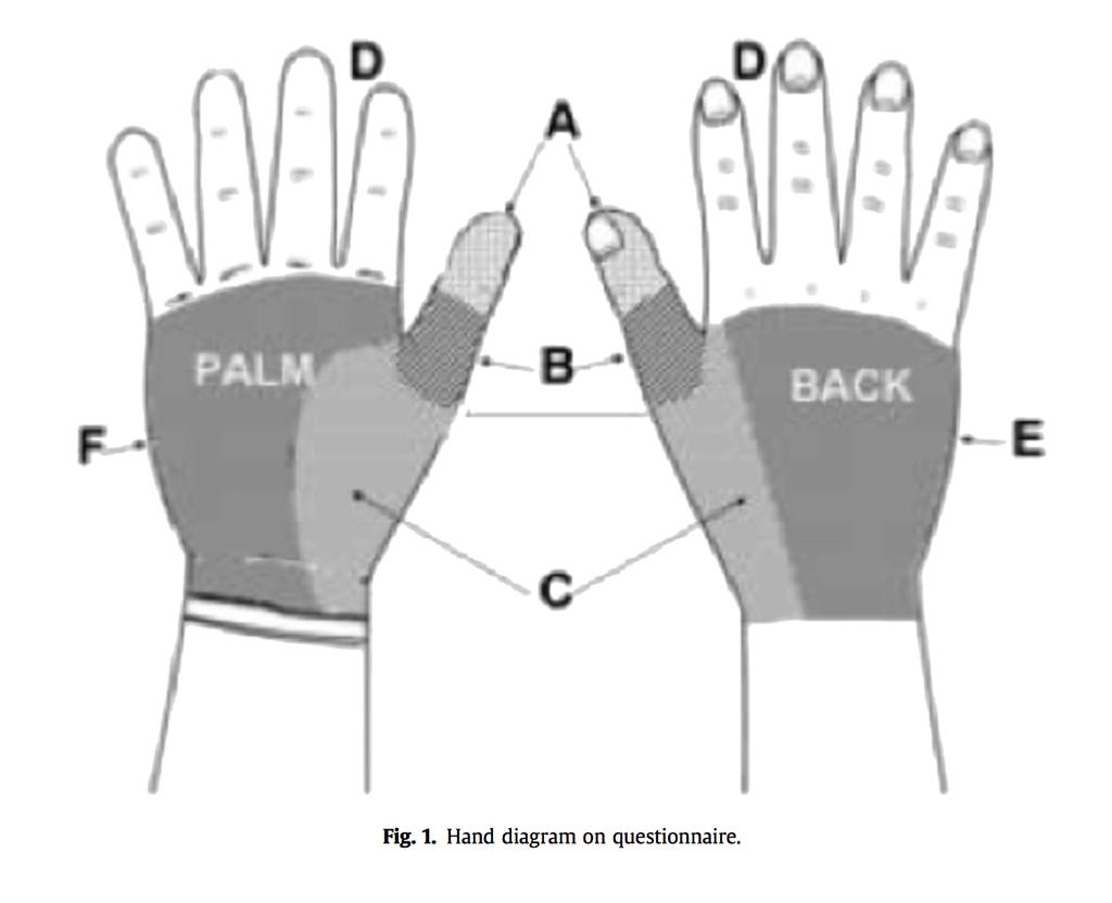 Musculoskeletal symptoms among mobile hand- held device users and their