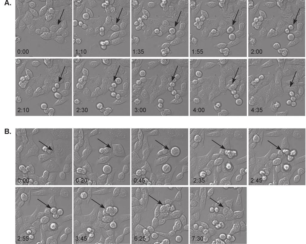 Zastosowanie mikroskopii do badań przyżyciowych cyklu komórkowego 215 Ryc.1. Prawidłowy i nieprawidłowy podział komórki.