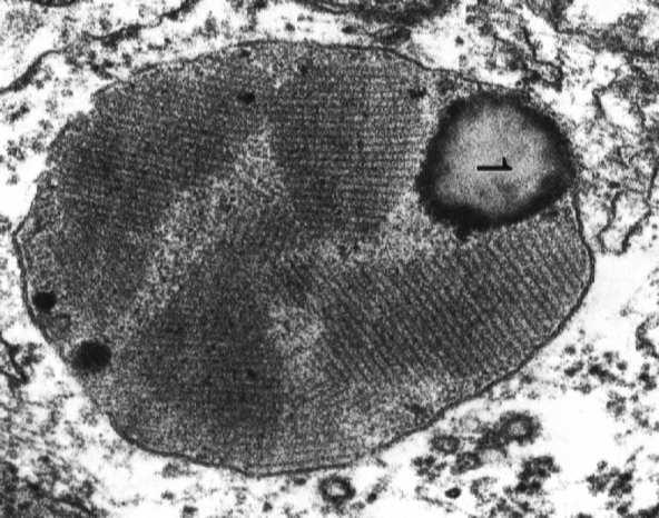 GFAP (kwaśne komórki neurogleju włókienkowe białko glejowe) neurofilamenty