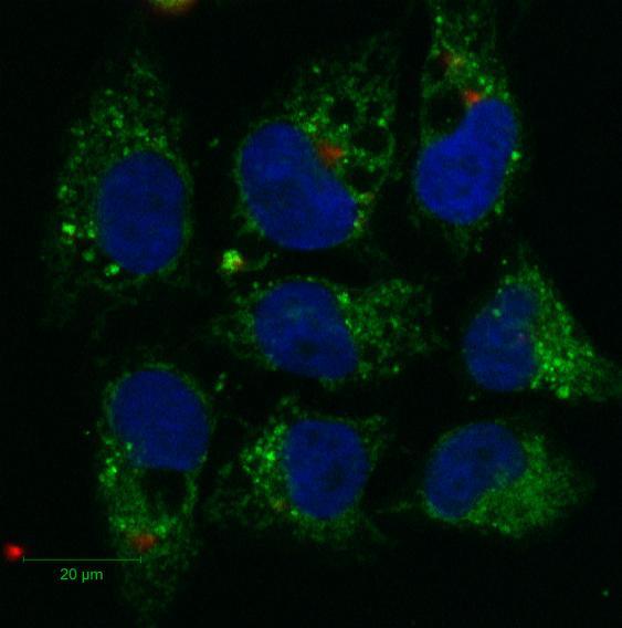 a) 0,2 µm b) 2 µm c) 20 µm roztworem nanocząstek Gd 2 O 3