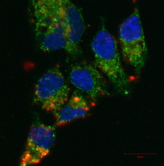 Upkonwersja nanocząstek: pobudzenie laserem