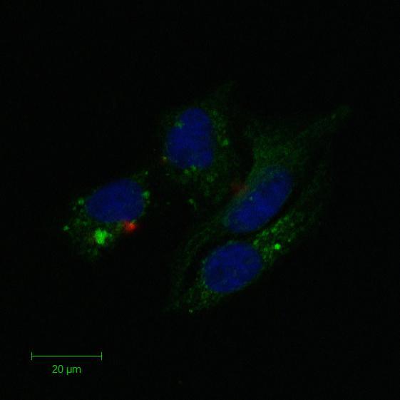 0,2 µm 2 µm 20 µm Rys. 73.