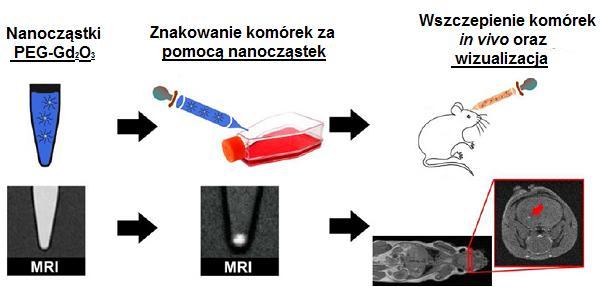 Rys. 4. Wykorzystanie nanocząstek PEG-Gd 2 O 3 jako środka kontrastowego w obrazowaniu metodą rezonansu magnetyczego MRI [38].