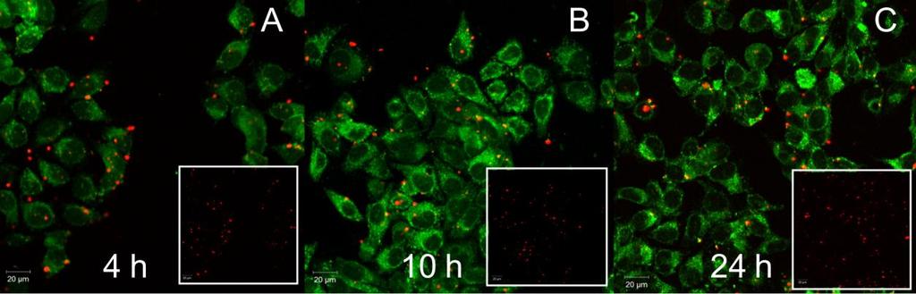 Rys. S19. Obrazy konfokalne komórek HeLa po) 4 h, b) 10 h i c) 24 h inkubacji z 25 µg ml -1 roztworem, pokrytych PVP nanocząstek z 50% koncentracją Zn 2+, z lipofektaminą 2000.