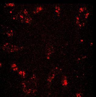 Nanocząstki ZnAl 2 O 4 : Er 3+,Yb 3+