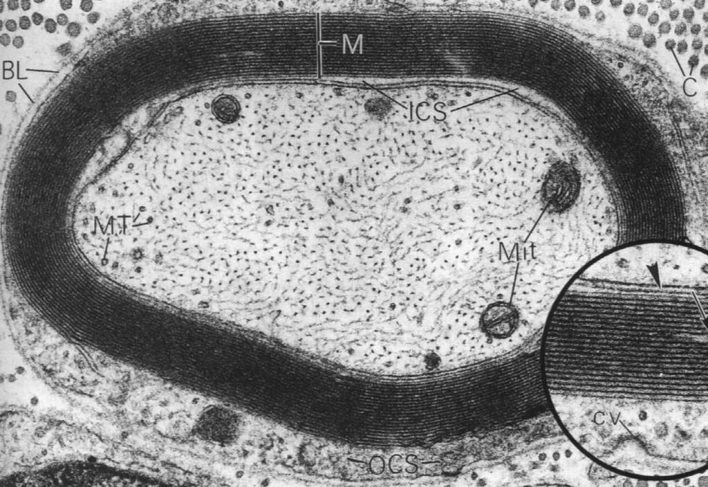 szczególną osłonkę mielinową, również wytworzoną przez komórki Schwanna Mielinizacja Wpuklenie błony komórki Schwanna
