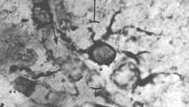 Oligodendrocyty wytwarzają osłonki mielinowe wokół ów ośrodkowego