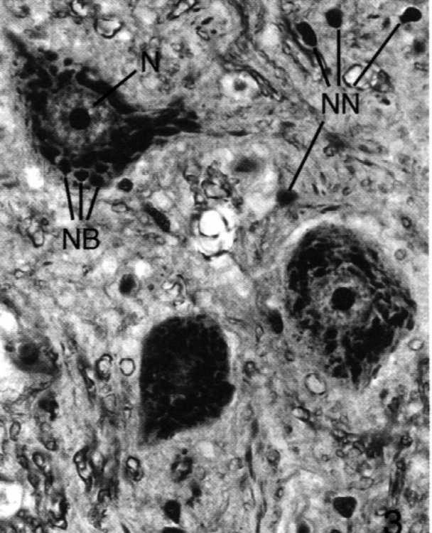 Ośrodkowy układ nerwowy Istota szara: perykariony komórek nerwowych niezmielinizowane włókna nerwowe