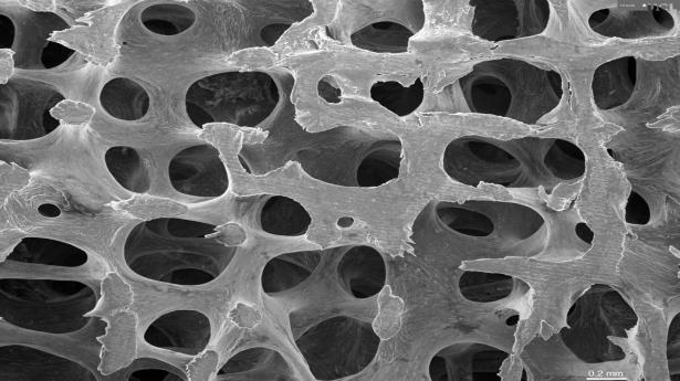 Bioceramika Biomateriały - wszelkie substancje obojętne chemicznie i farmakologicznie, nieaktywne w stosunku do żywych tkanek, przeznaczone na wszczepy lub stanowiące materiał do budowy urządzeń