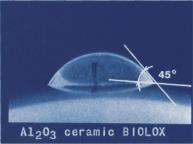patent na protezę stawu biodrowego z tlenku glinu, lata 1970-80 nowe materiały na ubytki kostne (HAp) i protezę (ZrO 2 ), lata 90
