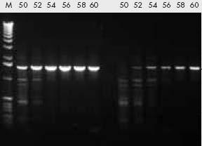 Optymalizacja warunków PCR Bufor standardowy bufor zawiera 50 mm KCl i 10 mm Tris-HCl, ph 8,3. Podniesienie stężenia KCl do 70 100 mm może zwiększyć wydajność syntezy fragmentów o długości <500 pz.