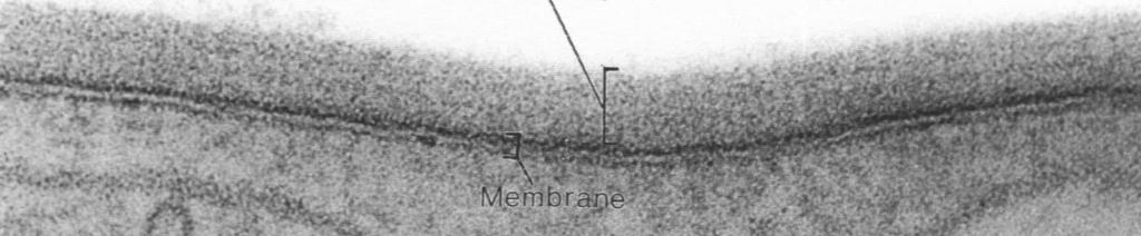 5 nm) trójwarstwowy obraz w mikroskopie elektronowym asymetryczne rozmieszczenie fosfolipidów w