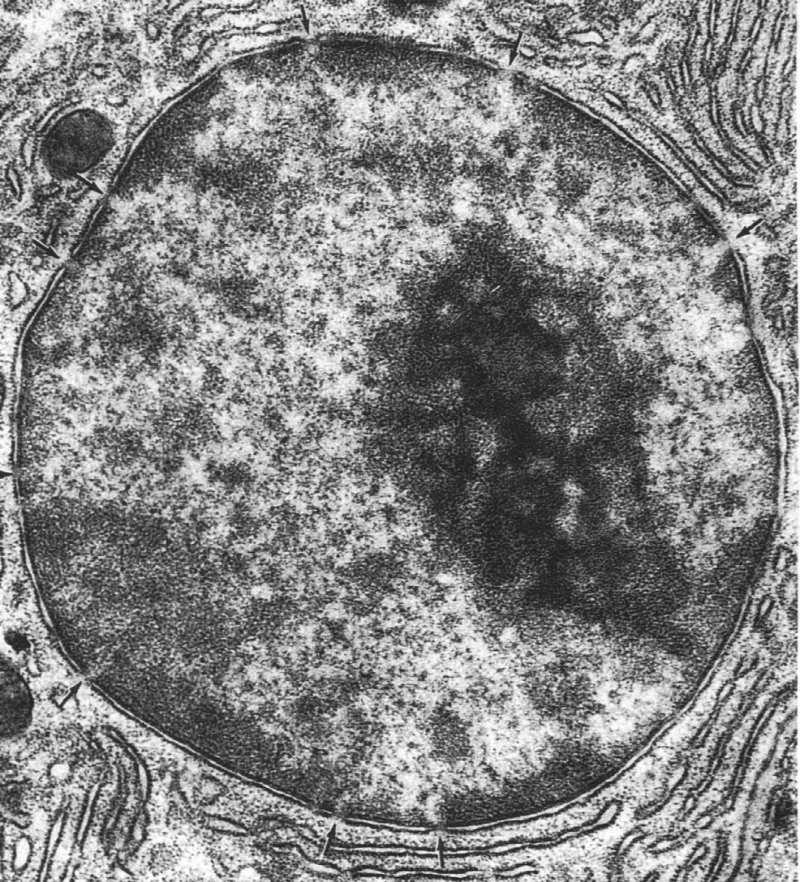 strukturalne) Typy chromatyny: euchromatyna (jasna, rozproszona, aktywna