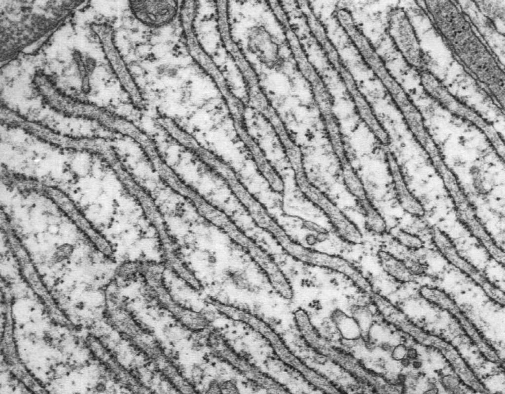 Biosynteza białka na wolnych (cytoplazmatycznych) rybosomach Biosynteza białka na rybosomach siateczki śródplazmatycznej 2 1 3 łańcuch polipeptydowy 3 4 5 odcinek sygnałowy SRP 1.