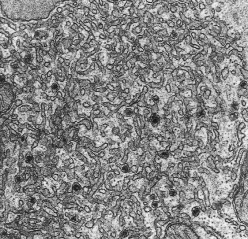 Zakończenie translacji rybosom rozpada się na oddzielne podjednostki i odłącza od mrna. 4 receptor i translokon 1. Przyłączenie mrna do małej podjednostki rybosomu. 2.