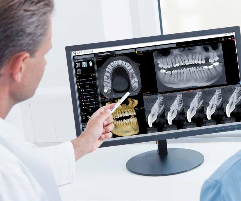 MILOWY KROK W STOMATOLOGII CYFROWEJ Od dziś jedno z najdoskonalszych urządzeń 3D Carestream Dental oferuje lekarzom możliwość obrazowania cefalometrycznego.