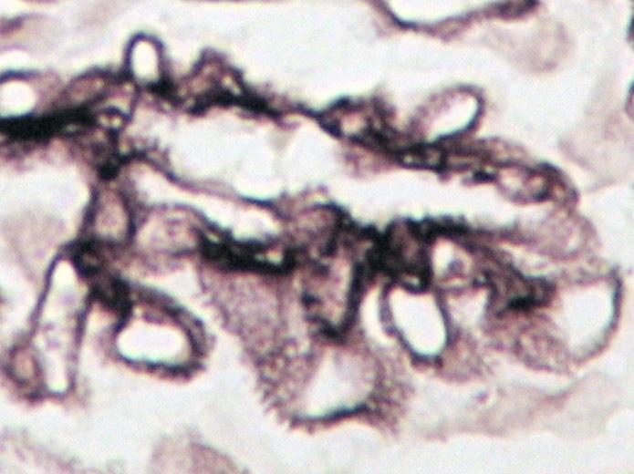 Na zewnętrznej powierzchni GBM widoczne są liczne srebrochłonne wypustki błony podstawnej. Srebrzenie metodą Jonesa. Membranous GN, stage II.