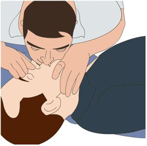 Sztuczne oddychanie Przy podejrzeniu uszkodzenia kręgosłupa szyjnego w wypadku komunikacyjnym należy zrezygnować z odchylenia głowy! Metody sztucznego oddychania: 1.