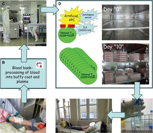 Przygotowanie limfocytów Treg do celów terapeutycznych Cząsteczki pozwalające na izolację limfocytów Treg do celów terapeutycznych: CD4 CD25 high CD127 low FOXP3 Marek-Trzonkowska N. et all.