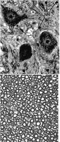 Ośrodkowy układ nerwowy Istota szara: perykariony komórek nerwowych niezmielinizowane włókna nerwowe astrocyty protoplazmatyczne liczne naczynia krwionośne