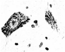 Komórka nerwowa Organelle: tigroid aparat Golgiego mitochondria lizosomy cytoszkielet W