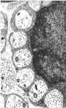 nerwowe = akson otoczony osłonką Osłonki aksonu są wytwarzane przez komórki neurogleju: w OUN przez komórki Schwanna in