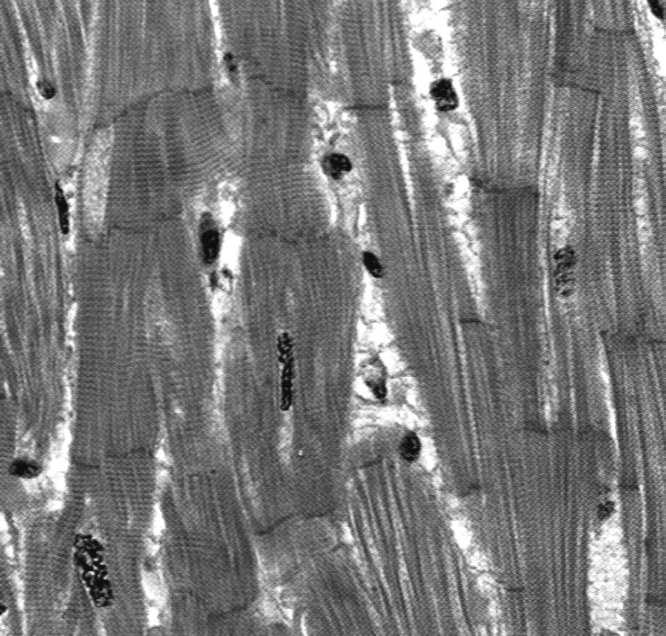 białe: większa średnica, mniej mioglobiny i mitochondriów, węższe