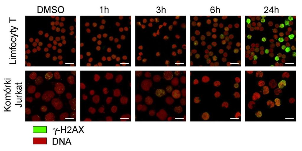 Wyniki 5.3.2. Markery uszkodzeń DNA w komórkach traktowanych kurkuminą Jednym z markerów uszkodzeń DNA jest fosforylacja seryny 139 białka H2AX.