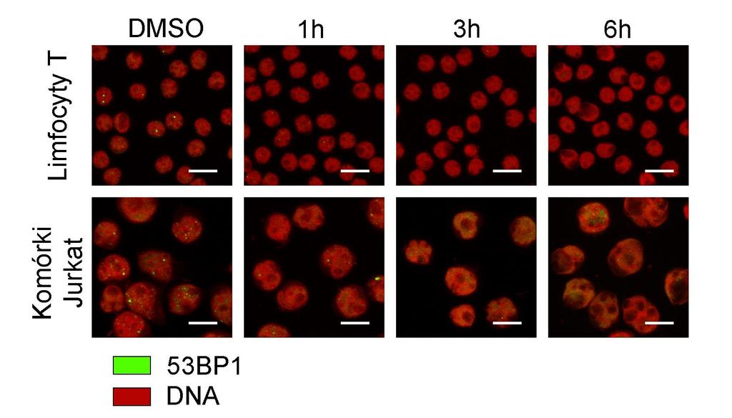 Wyniki 1, 3, 6 godzinach, a kontrolą były komórki traktowane DMSO (0,5%; 1 godzina). Kurkumina nie powodowała formowania skupisk 53BP1 w badanych komórkach. Rys. 5.20.