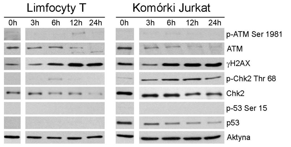 Wyniki Rys. 5.22. Wpływ kurkuminy na poziom kluczowych białek szlaku DDR. Komórki traktowano 50µM kurkuminą.