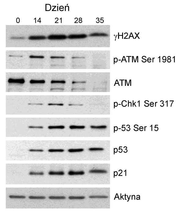 Wyniki 5.4.4. Aktywacji szlaku DDR podczas starzenia replikacyjnego limfocytów T Barwienie immunocytochemiczne wykazały obecność uszkodzeń DNA w limfocytach T indukowanych do starzenia replikacyjnego.