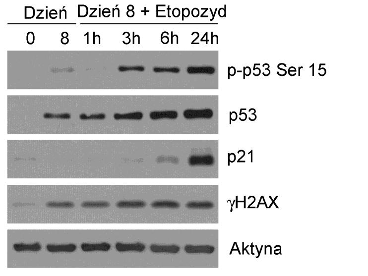 Wyniki (dzień 8) traktowanych 0,1µM etopozydem po 1, 3, 6 i 24 godzinach. Kontrolę stanowiły limfocyty T spoczynkowe oraz aktywowane, nietraktowane etopozydem (dzień 8) (Rys. 5.31.). W 8 dniu hodowli aktywowanych limfocytów T zaobserwowano wzrost poziomu fosforylowanego i całkowitego p53 oraz γh2ax względem komórek spoczynkowych.