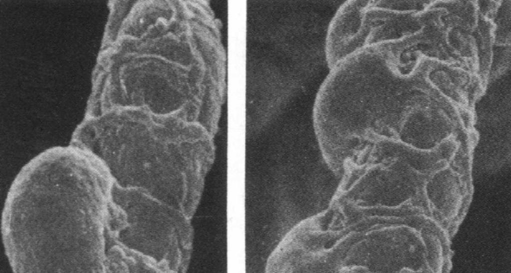 włosowate (kapilary, średnica 5-10 µm) odpowiadają za wymianę gazów i