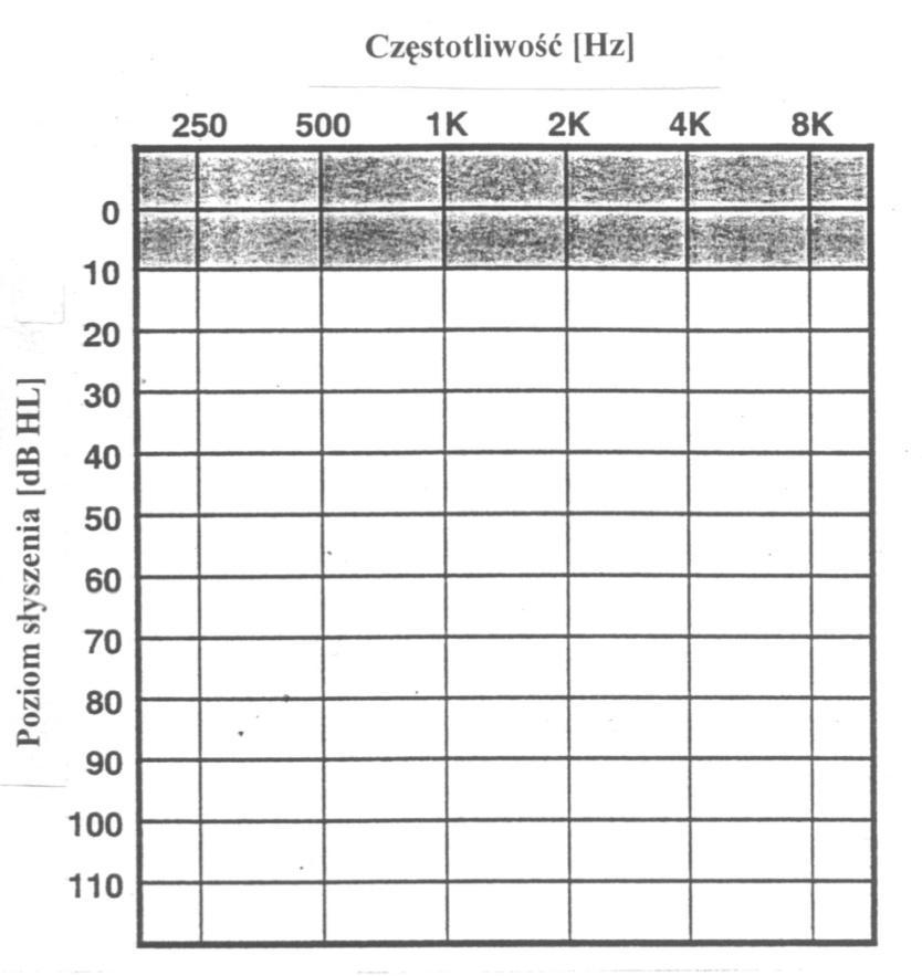 Audiogram tonowy Celem audiometrii tonalnej jest wyznaczenie progu słyszenia w zakresie częstotliwości słyszalnych istotnych dla komunikacji międzyludzkiej.