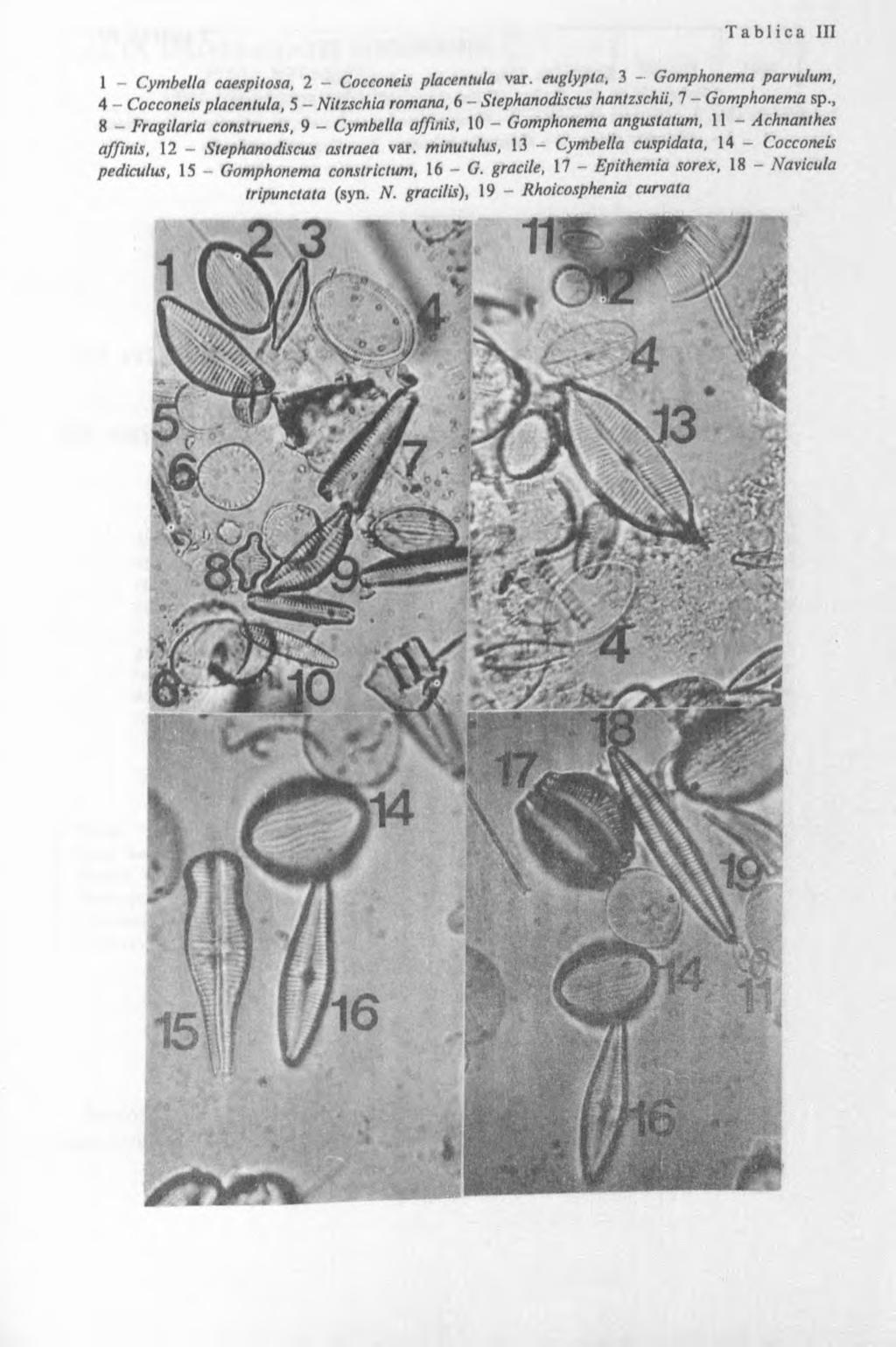 1 CymbeUa caespitosa, 2 Cocconeis placentula var. euglypta., 3 Gomphonema parvulum, 4 Cocconeis placentula, 5 Nitzschia romana, 6 Stephanodiscus hantzschii, 7 Gomphonema sp.