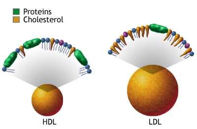 Miażdżyca (arterioskleroza) to jedna z najczęstszych chorób krążenia. Powstaje, gdy we krwi krąży dużo złego cholesterolu.