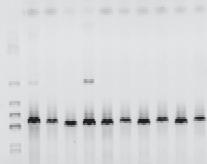 2001, 2003, Hutkins 2006, Settanni i Moschetti 2010]. Spośród wymienionych rodzajów LAB w większości serów regionalnych dominują bakterie Lactobacillus.