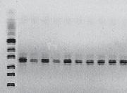 Analiza mikroflory regionalnych serów gołka 33 M K 1 2 3 4 5 6 7 8 9 150pz 100pz M marker O Gene Ruler DNA Ladder Ultra Low Range; K kontrola dodatnia E.