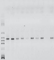 faecium ATCC 27270, 2 9 samples of the golka cheese Primers Entgr1F/Entgr2R were used for detection Enterococcus sp. Fot. 3.