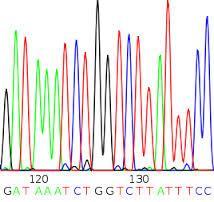 PCR w czasie rzeczywistym (Q-PCR)
