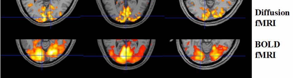 Dodatkowo Le Bihan dowodzi, że lokalizacja aktywności neuronalnej na mapach dyfuzji czynnościowej jest znacznie precyzyjniejsza, co wynika wprost z założenia, że dyfuzja cząsteczek wody następuje w