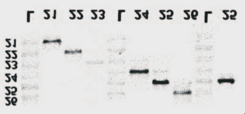 100 D. Monies, P. Kozio³, R. M¹dro extraction method according to Künkel et al. [4]. PCR reactions were carried out in 25 l and consisted of 1ng DNA template, 0.