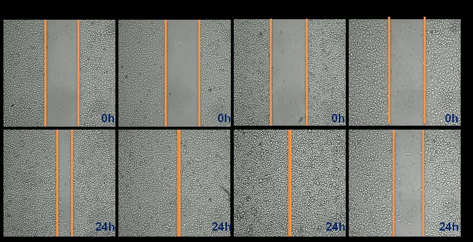 Czas [h] Rysunek 7 Test wound healing, porównanie stopnia zarośnięcia przerwy po 24h w badanym układzie komórkowym. Obiektyw 4X i powiększenie cyfrowe 10x.