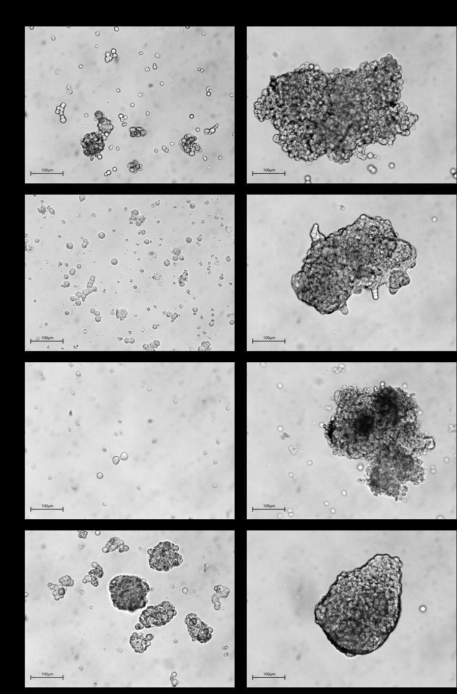 Rysunek 11 Przykładowe zdjęcia mikrosferoidów tworzonych przez